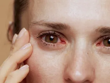 Illustration Trockenes Auge